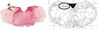 Investigation of the Role of AT2 Receptors in the Nucleus Tractus Solitarii of Normotensive Rats in Blood Pressure Control